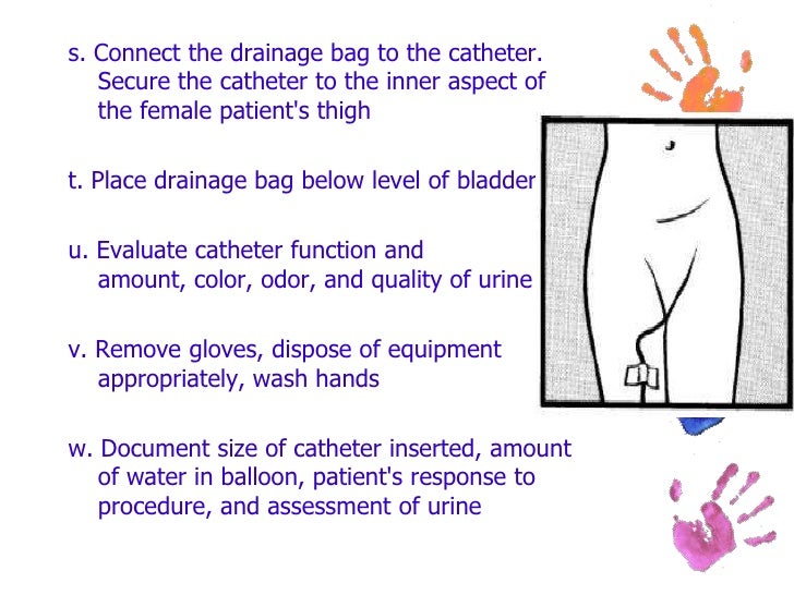 Female Catheter Insertion Procedure Female Catheter Insertion Procedure